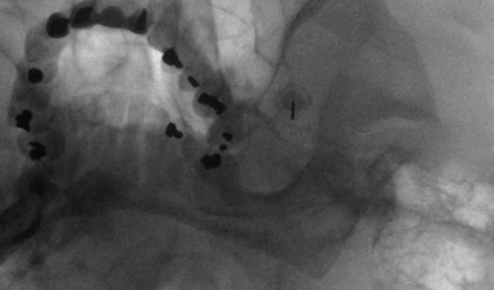 Our Project One Image 5